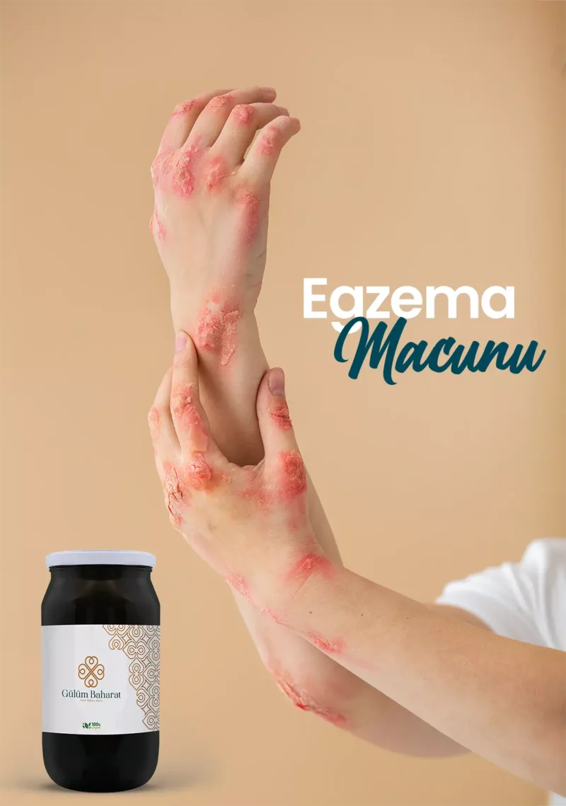 Egzema Macunu - Görsel 2